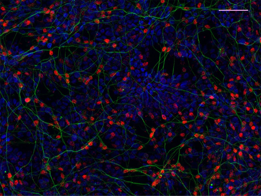 In vitro differentiation