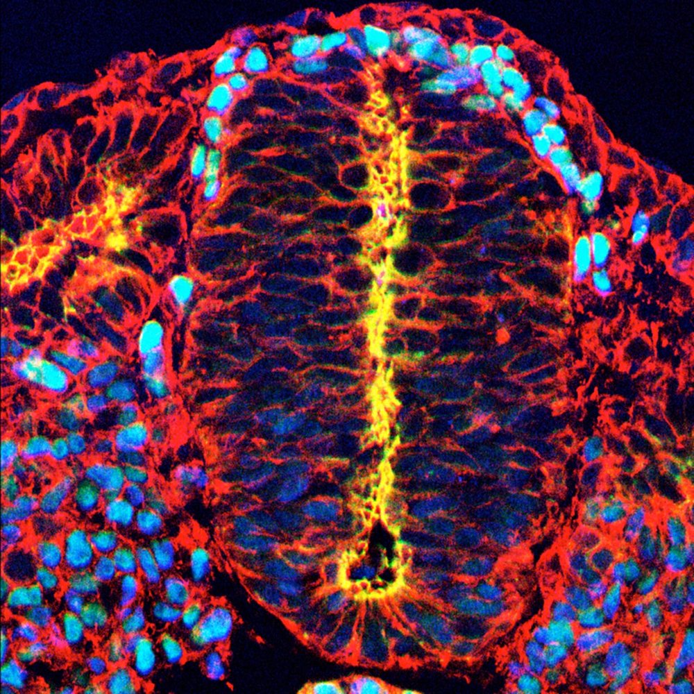 Neural Crest Emigrating