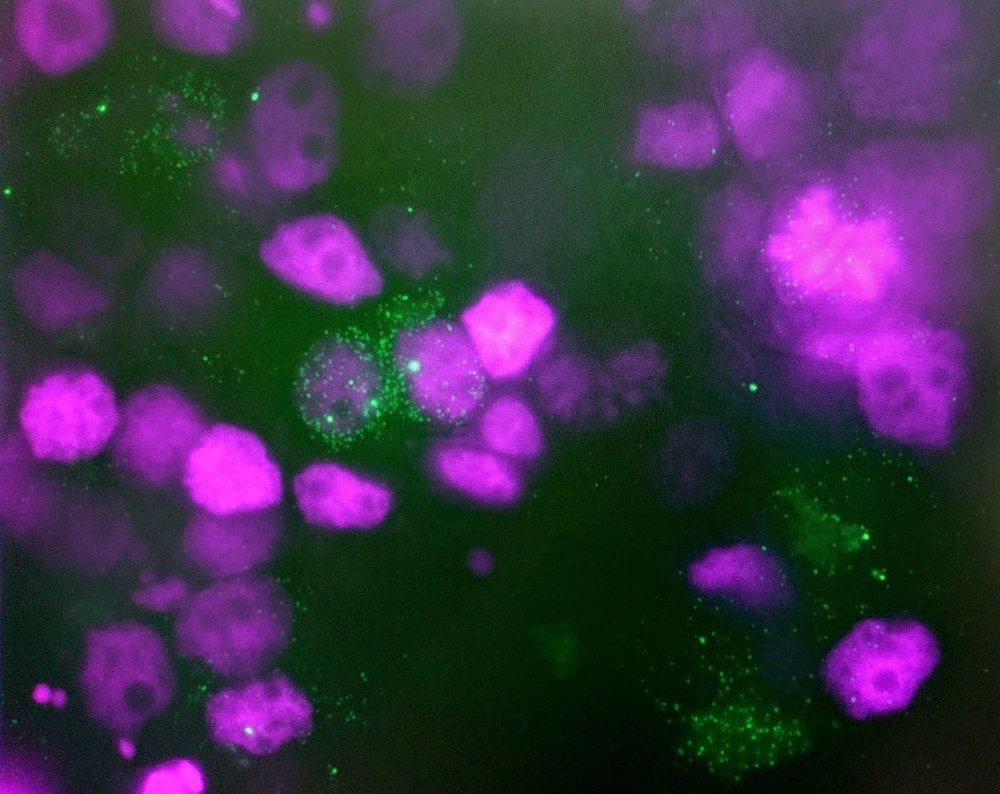 Single Molecule FISH