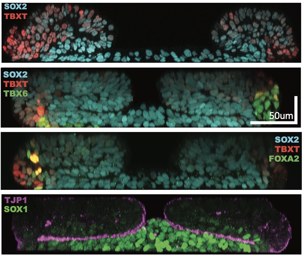 Four transverse sections through human stem cell derived trunk organoids, each stained for a different combination of markers: SOX2 with TBXT, SOX2 with TBXT and TBX6, SOX2 with TBXT and FOXA2, and TJP1 with SOX1